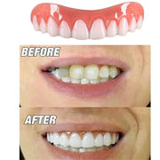 Upper and Lower Teeth