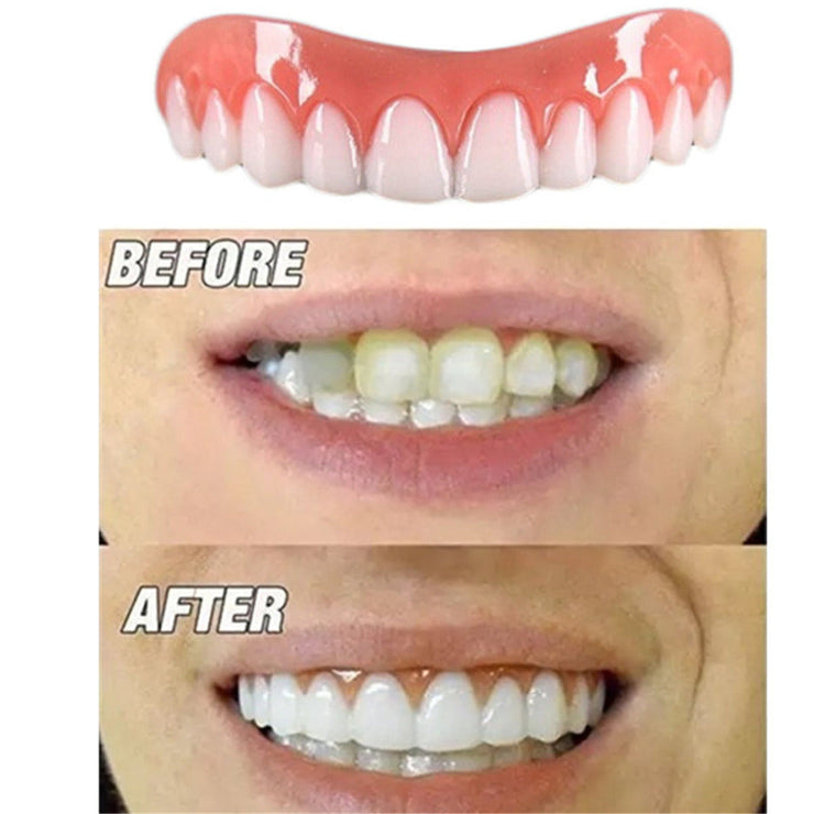 Upper and Lower Teeth