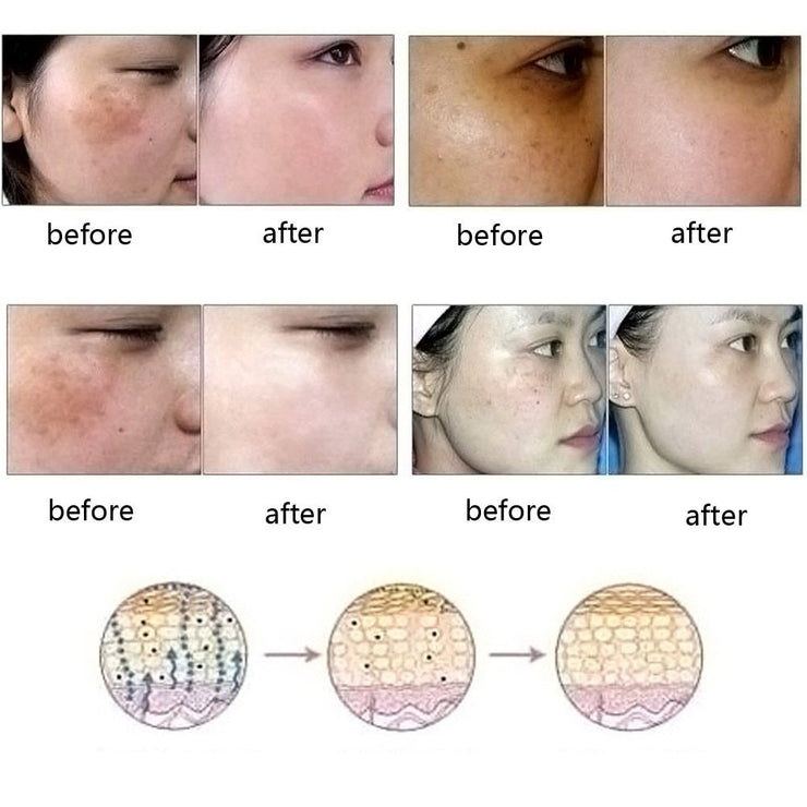 Dredge Meridian Skin Care Essence Oil