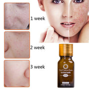 Dredge Meridian Skin Care Essence Oil
